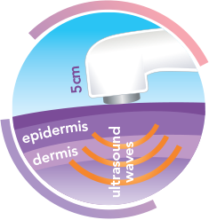 Ultrasound how it works 2