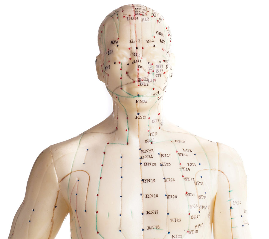 Acupuncture services needle points on body